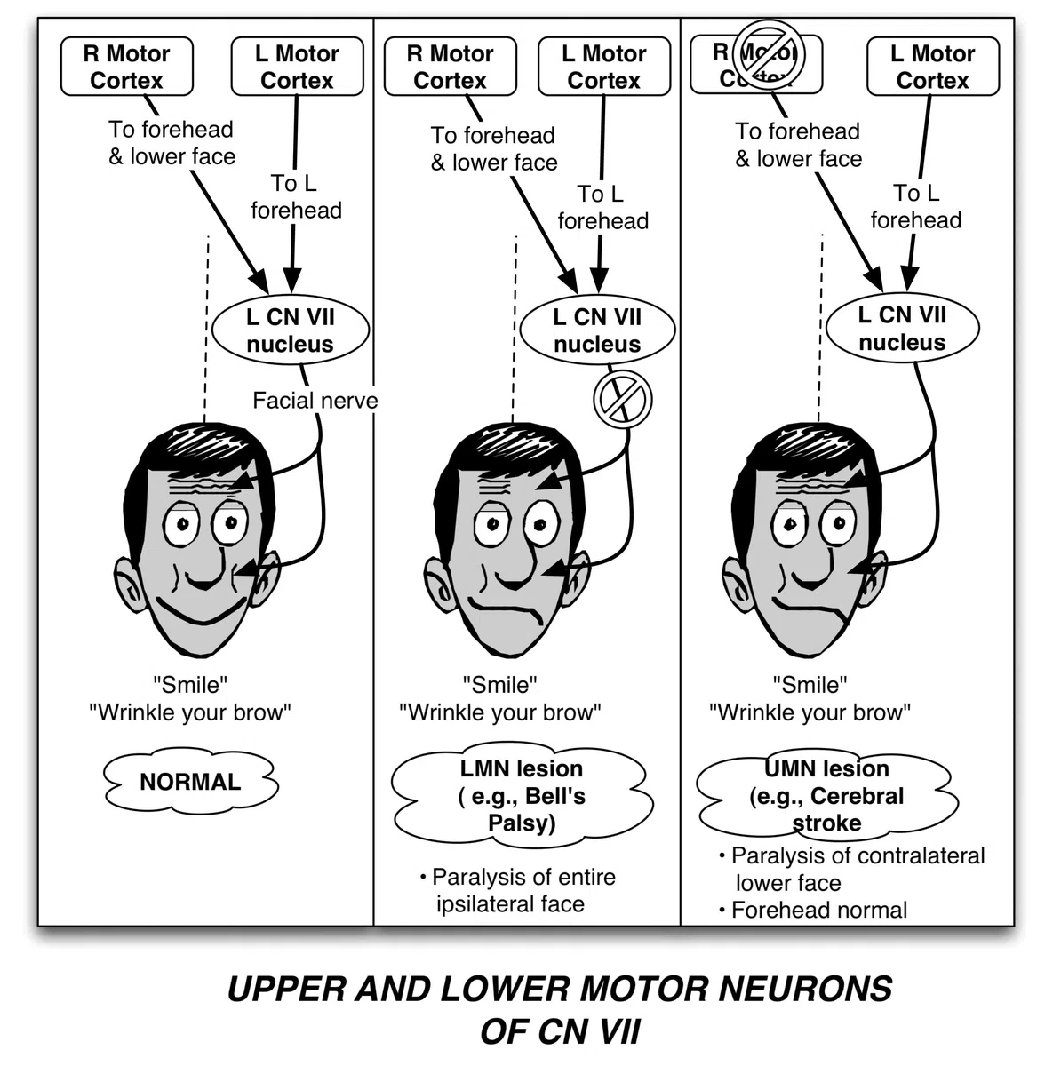 Pathophysiology Made Ridiculously Simple [With CD-ROM]