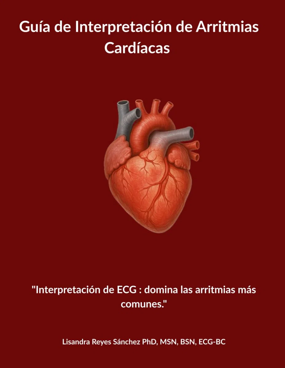 Guía de Interpretación de Arritmias Cardíacas: "Interpretación de ECG : domina las arritmias más comunes."