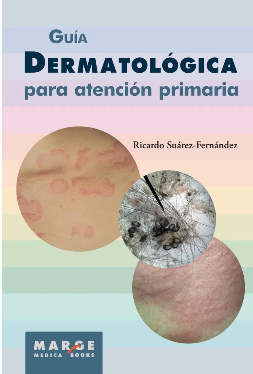 Guía dermatológica para atención primaria (Medicina y Ciencias de la Salud)